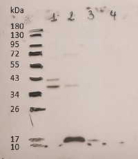 Api g 1 | Major allergen Api g 1, isoallergen 2 in the group Antibodies Plant/Algal / Food Proteins/Allergens at Agrisera AB (Antibodies for research) (AS19 4335)